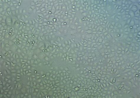 Rko Cells 人结肠腺癌细胞系低代次 培养基 赠str图谱 品牌 Atcc、dsmz等 美国、欧洲、德国等 Chemicalbook