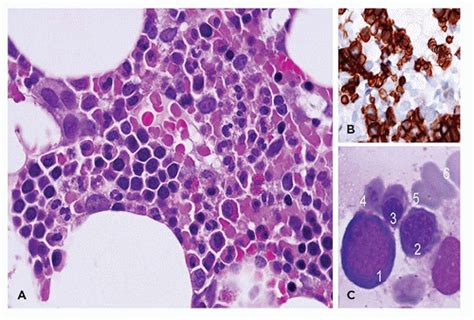 The Bone Marrow | Basicmedical Key