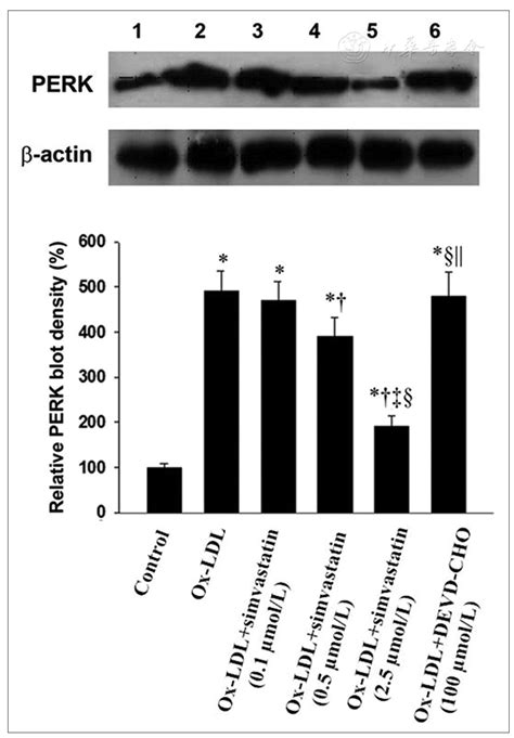 Inhibitory Effects Of Simvastatin On Oxidized Low Density Lipoprotein