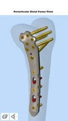 Locking Plates Periarticular Distal Femur Plate Manufacturer From