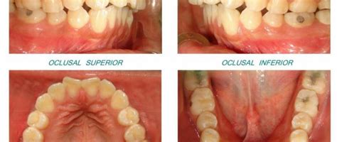 Inicio Oral Rx Diagnóstico Radiológico Radiografías Intraorales Radiografías Extraorales