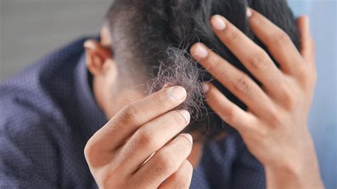 Diet Not Fancy Hair Products Can Help Stop Hair Loss Heres Why