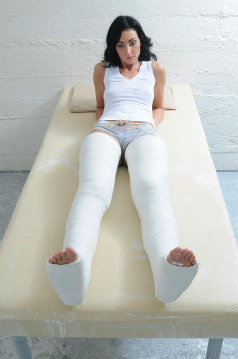 Casts 90 Ideas On Pinterest It Cast Leg Cast Arm Cast