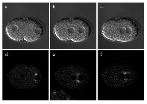 11 Pronucleus Movement Of C Elegans Embryo A C Nomarski Dic Download Scientific Diagram