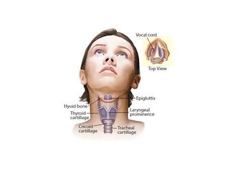 Laryngitis Carecure