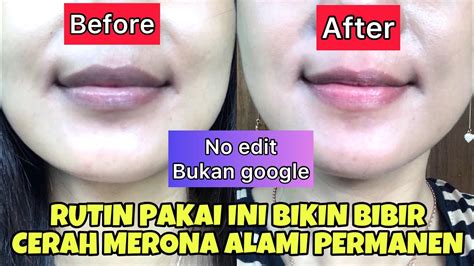 BYE BIBIR GELAP CARA MENCERAHKAN BIBIR GELAP AMPUH DAN PERMANEN