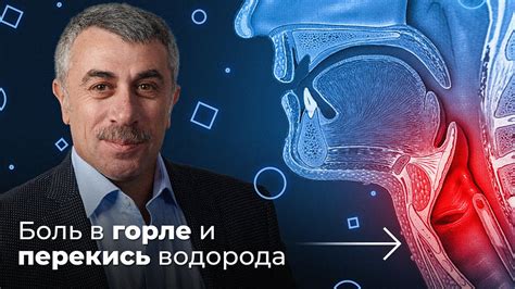 Полоскание горла перекисью водорода