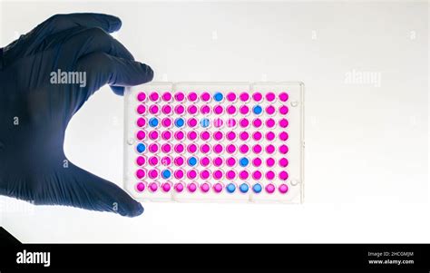 Enzyme Linked Immunosorbent Assay Elisa 96 Well Micro Plate