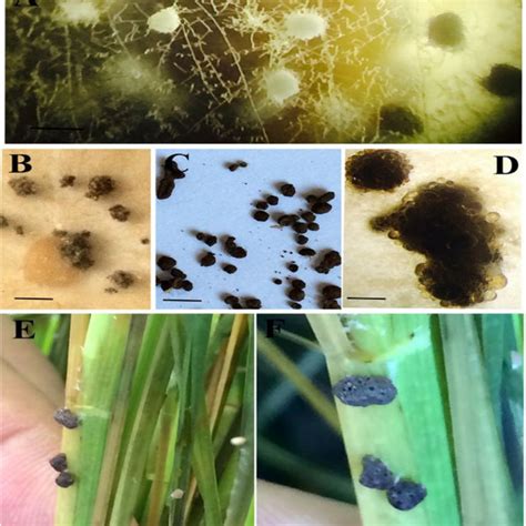 Sclerotial Features Of Rhizoctonia Solani A Immature Sclerotia With