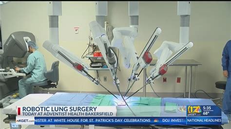 First Robotic Lung Surgery In Bakersfield At Adventist Health