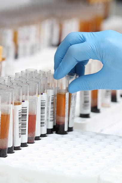 laboratory specimen stock  pictures royalty  images istock