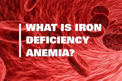 What Is Iron Deficiency Anemia Hho Hunterdon Hematology Oncology