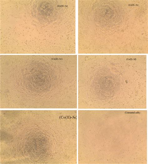 MCF‐7 cell morphology under treatment with Co(II) complexes (50 ppm) | Download Scientific Diagram