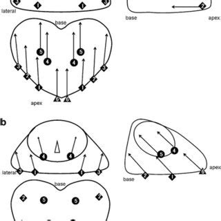 Scheme Of A Transperineal And B Transrectal Core Biopsy