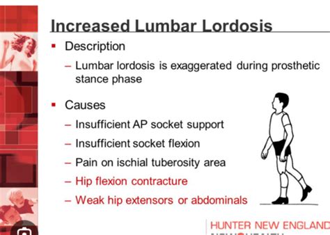 MSK Prosthesis Gait Deviations Flashcards Quizlet