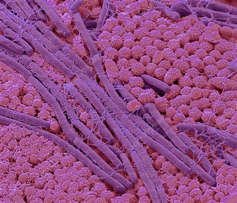 Tongue bacteria, SEM - Stock Image - F022/7998 - Science Photo Library