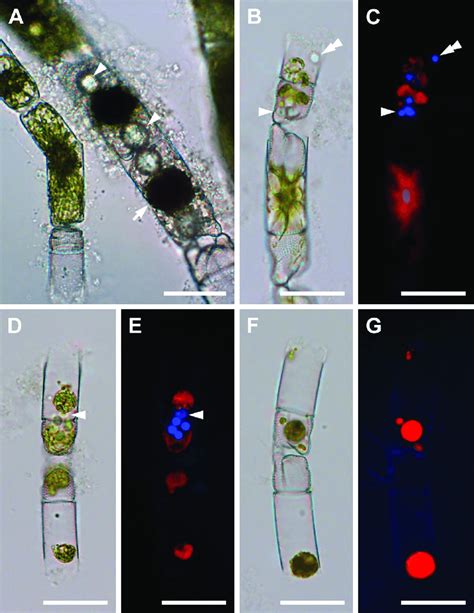 Spermatogenesis Brightfield And Dapi Stained Epifluorescence Light