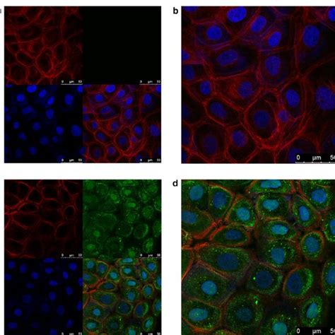 Overexpression Of E Oncogene In Hnscc Cells With A Stable Lentivirus