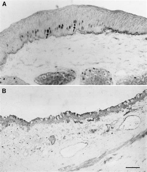 Photomicrograph of a cross-section through the mucocutaneous junction... | Download Scientific ...