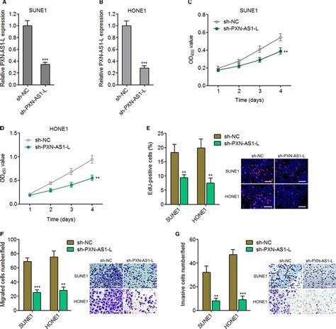 Silencing Of Pxn‐as1‐l Suppresses Nasopharyngeal Carcinoma Cell