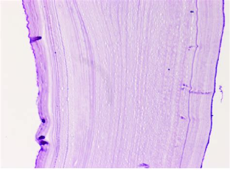 Histopathology Image Of The Hydatid Cyst Wall Consisting Of An Download Scientific Diagram