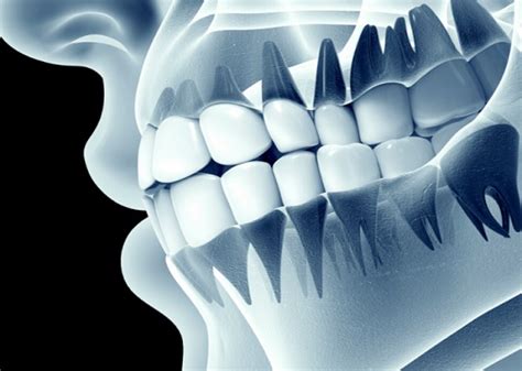 Scarsdale Advanced Dental |3D Dental X Rays