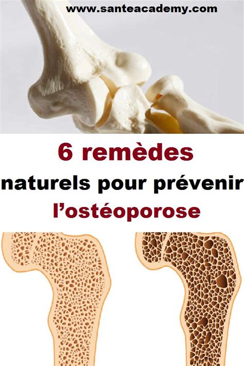 6 remèdes naturels pour prévenir lostéoporose Condiments Food Chicken