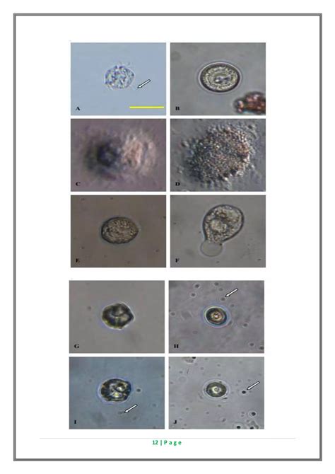 Life Cycle Of Protozoan Fish Parasite Pdf