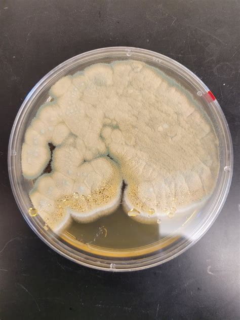 Yeast or Mold? : r/microbiology