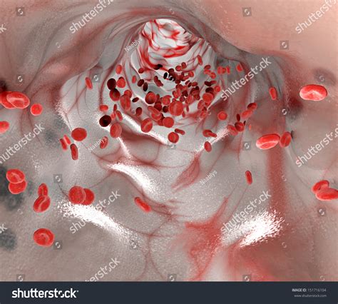 250 Hemoglobin Carbon Dioxide Images Stock Photos Vectors Shutterstock