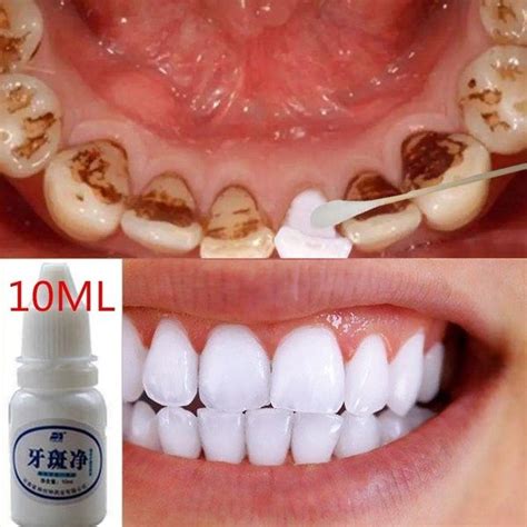 Ml Magic Natural Teeth Whitening Powder Pearl Tooth Brushing Powder