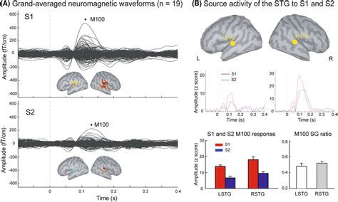 A Grand Averaged Auditory Evoked Responses And The Cortical Activation