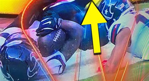 Photos Gruesome New Images Show Bone Popping Out Of Tank Dell S Knee