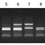 Genotyping Of Gstm And Gstt Polymorphisms By Multiplex Pcr Based