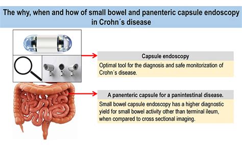 Topic Capsule Endoscopy Development Status And Future Expectations