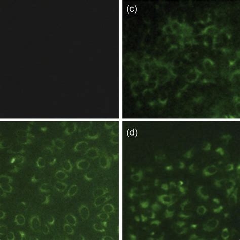 Detection Of Wnv Antigen In Vero Cells By Indirect Immunofluorescence