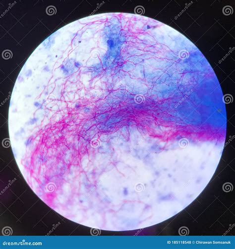 Red Branching Mycobacterium Tuberculosis on Blue Background in Modified ...