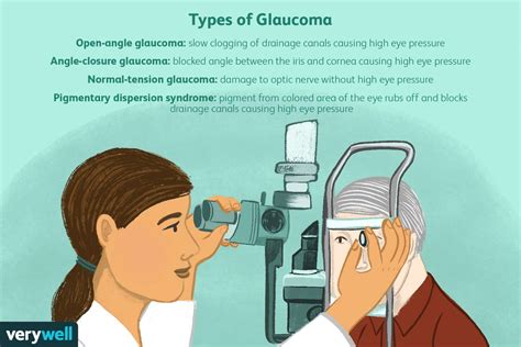 Glaucoma Diagnosis