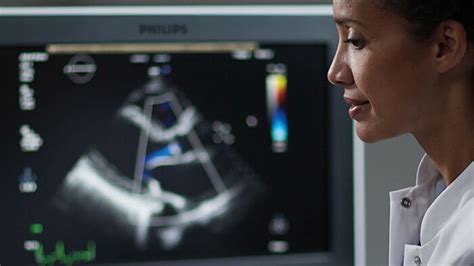 Coronary Artery Disease Philips