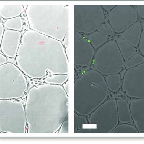 Example Of Circulating Angiogenic Cell Cac Association With Human