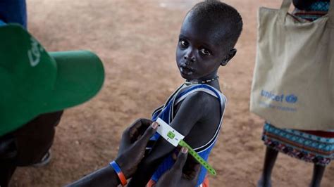 Près de 1 4 million d enfants risquent de mourir de faim cette année