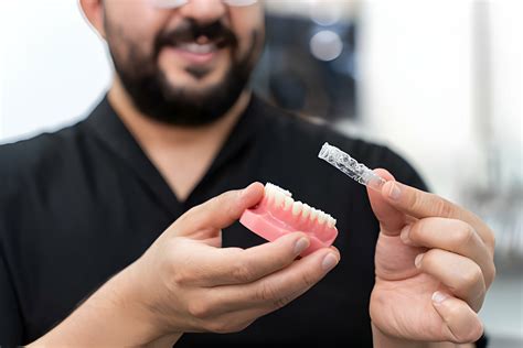 How Does Invisalign Work A Step By Step Explanation