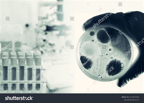 Petri Dish Microbiology Lab Research Blue Stock Photo 2172223075 ...