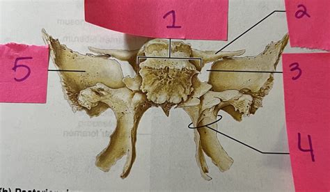 Posterior View Of Sphenoid Bone Diagram Quizlet