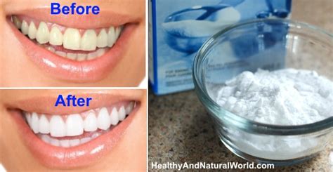 Best Teeth Whitening Home Remedies (Natural Teeth Whitening Methods)