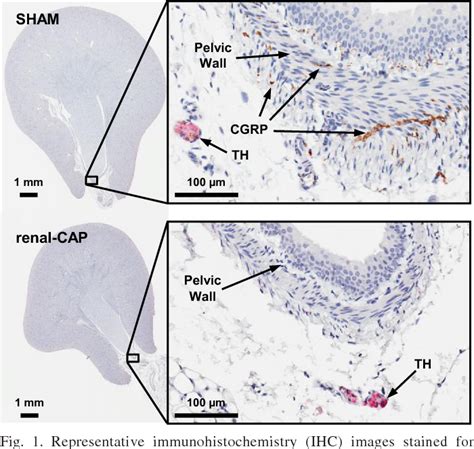 Figure 1 From A Novel Method Of Selective Ablation Of Afferent Renal