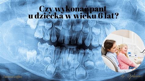 Planowanie Ekstrakcji Mleczak W W Kontek Cie Zgryzu Dental Coffee