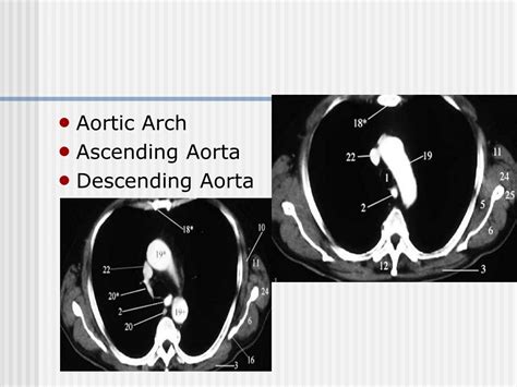 Ppt Cross Sectional Anatomy Powerpoint Presentation Free Download