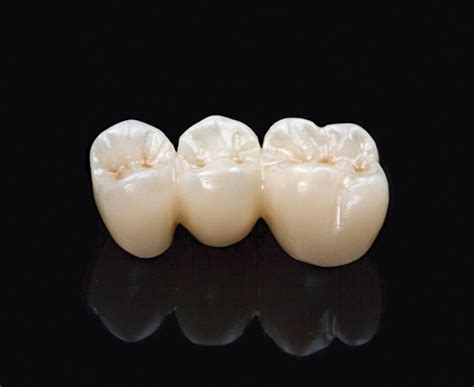 Monolithic Zirconia Westbrook