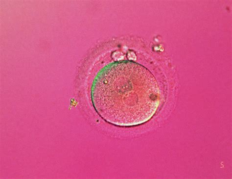 Lm Of Human Zygote During In Vitro Fertilisation Photograph By Science